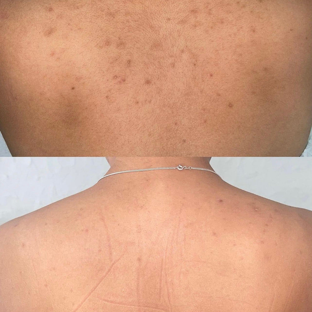 Skin Transformation Result