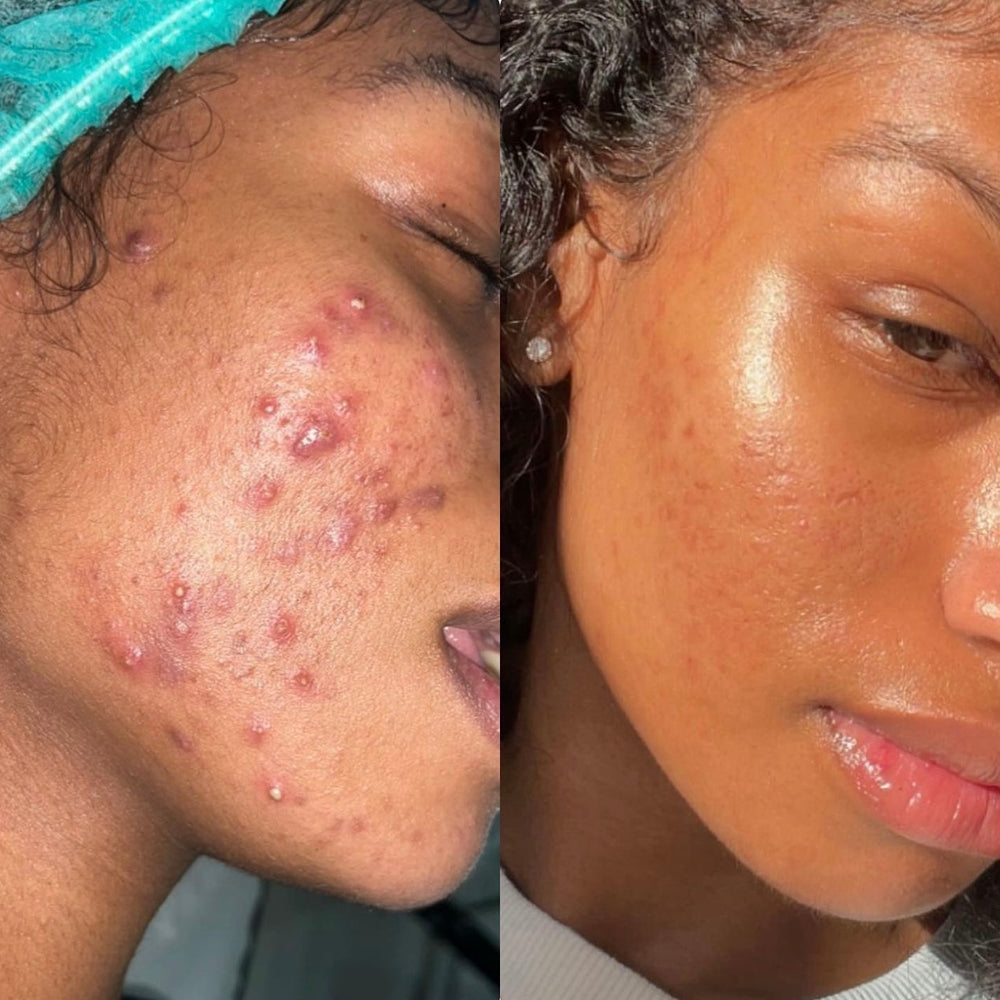 Skin Transformation Result