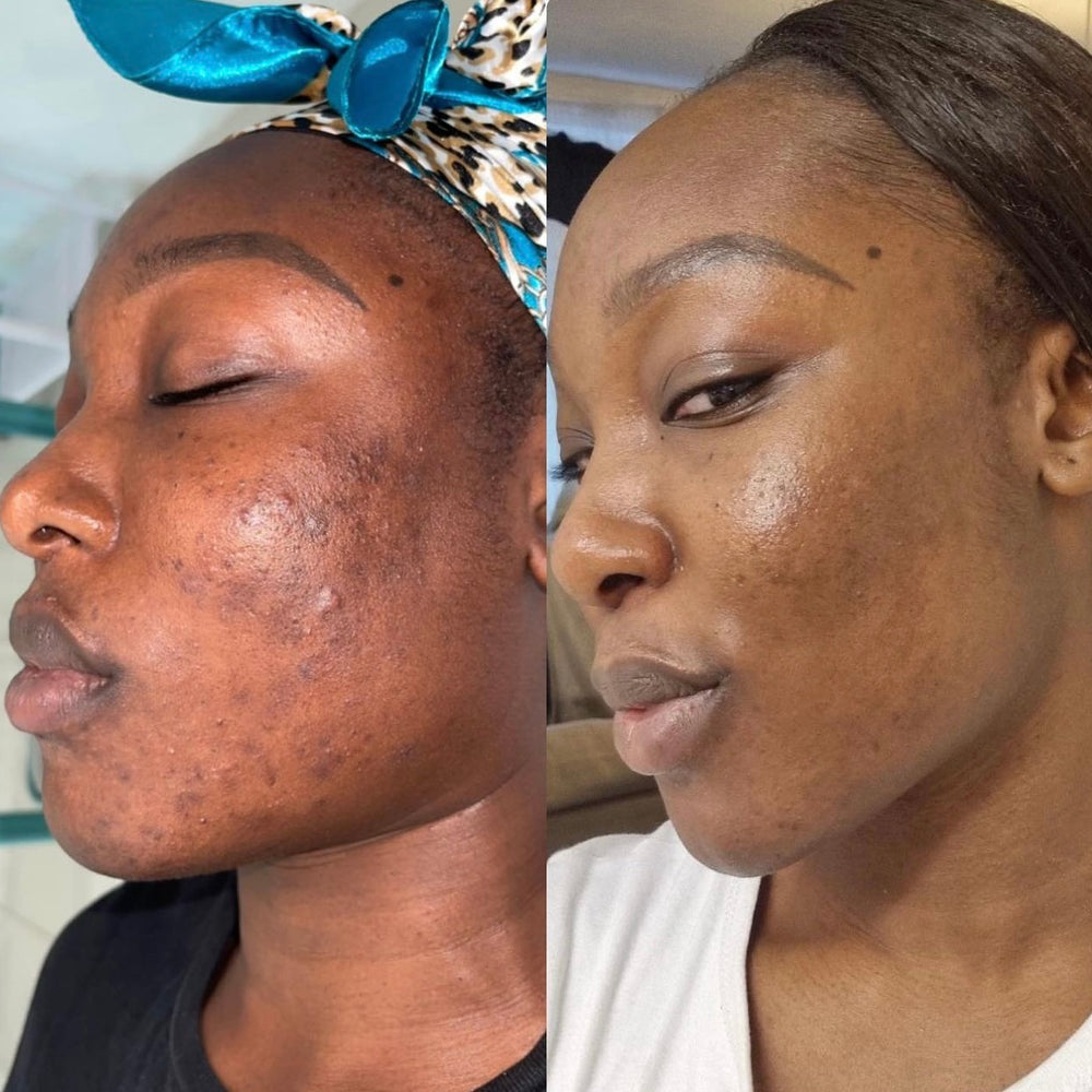 Skin Transformation Result