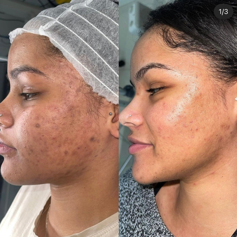 Skin Transformation Result