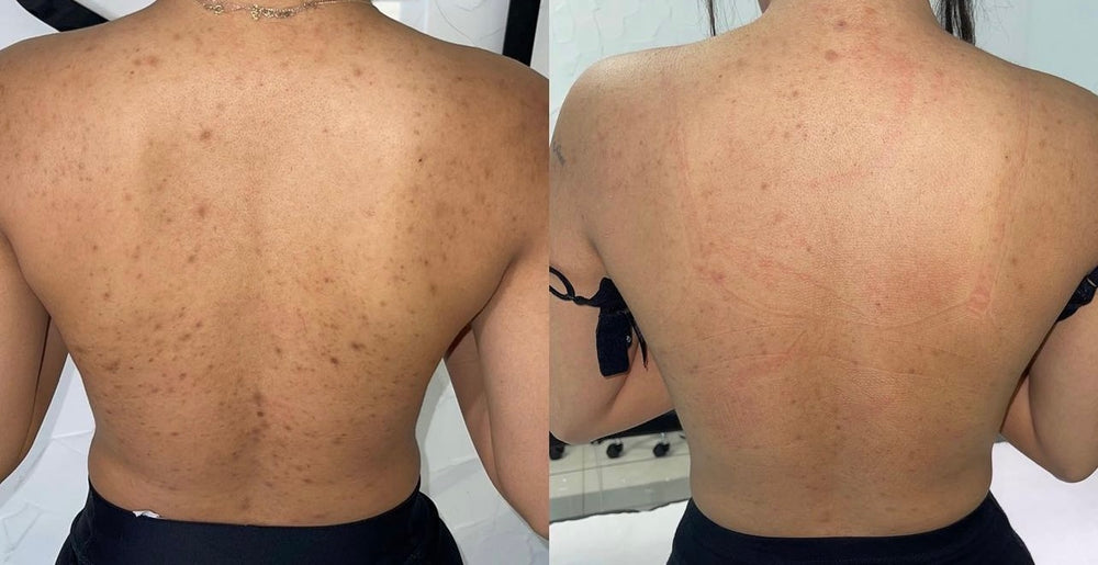 Skin Transformation Result