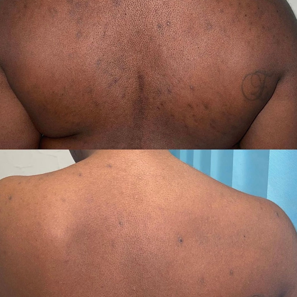 Skin Transformation Result