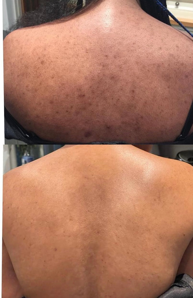 Skin Transformation Result