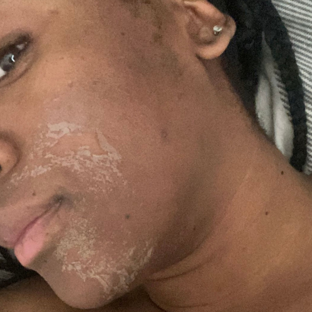 Skin Transformation Result