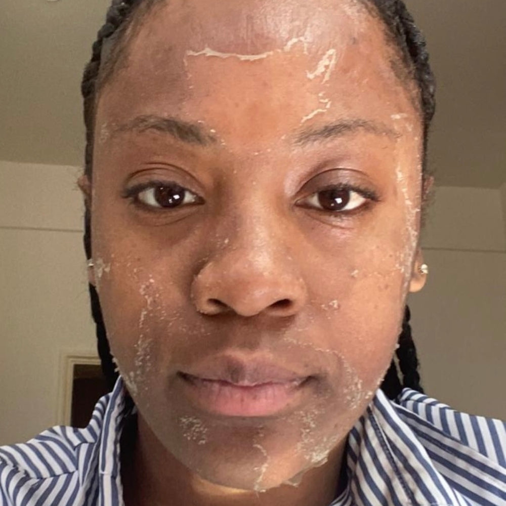 Skin Transformation Result