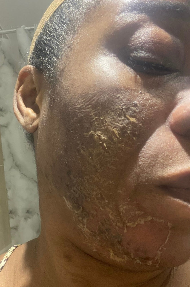 Skin Transformation Result