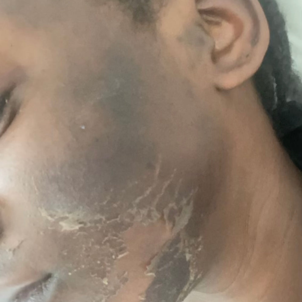 Skin Transformation Result