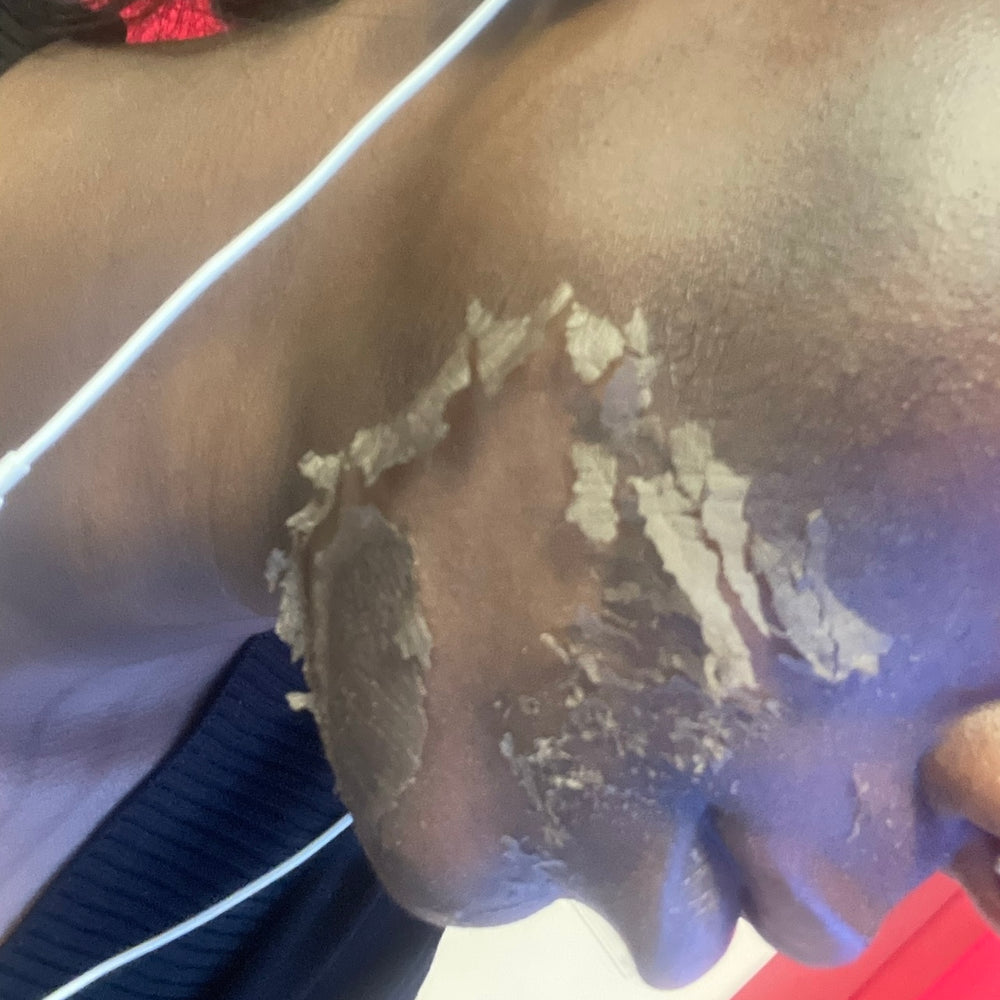 Skin Transformation Result