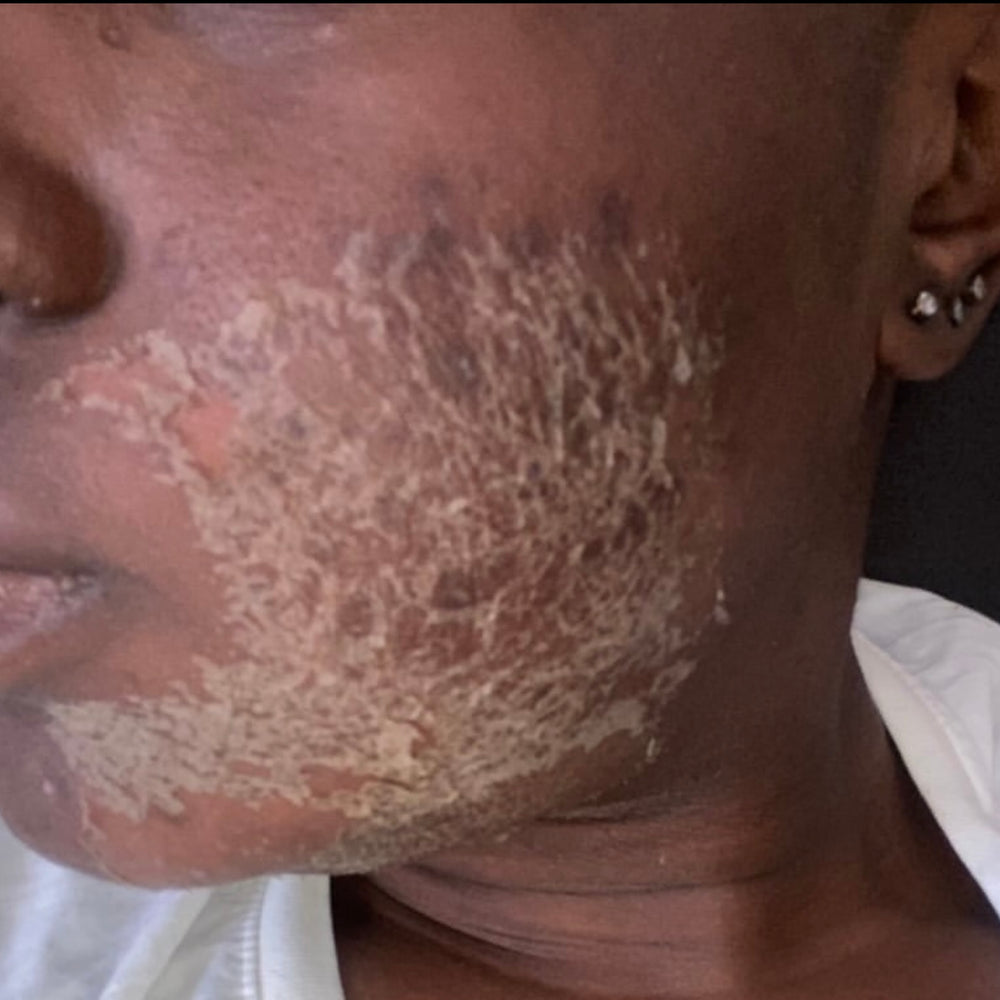Skin Transformation Result