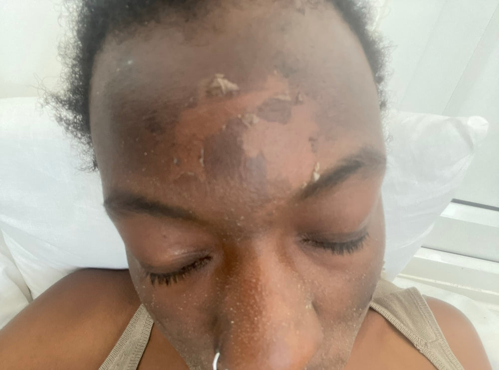 Skin Transformation Result