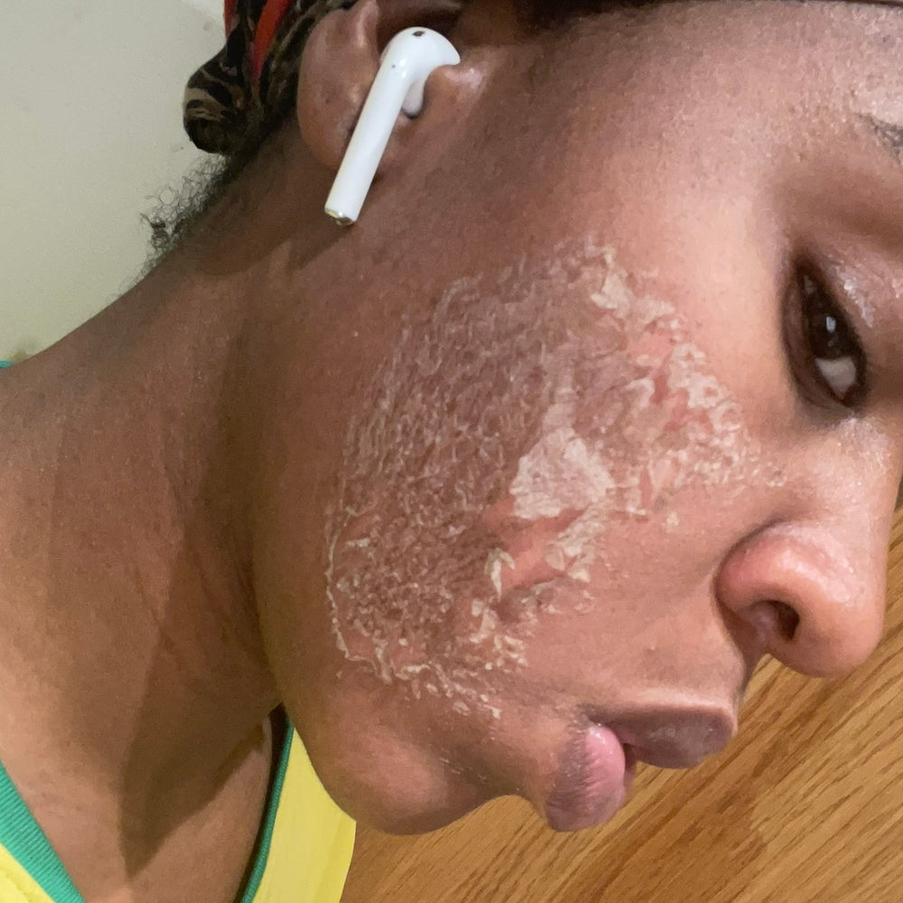 Skin Transformation Result