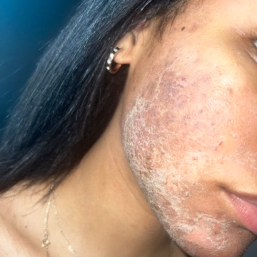 Skin Transformation Result