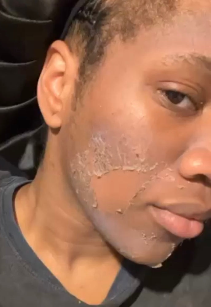 Skin Transformation Result