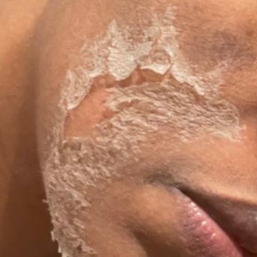 Skin Transformation Result