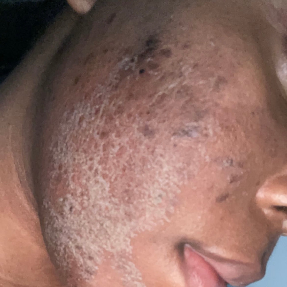 Skin Transformation Result