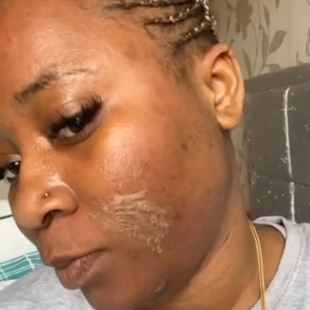 Skin Transformation Result