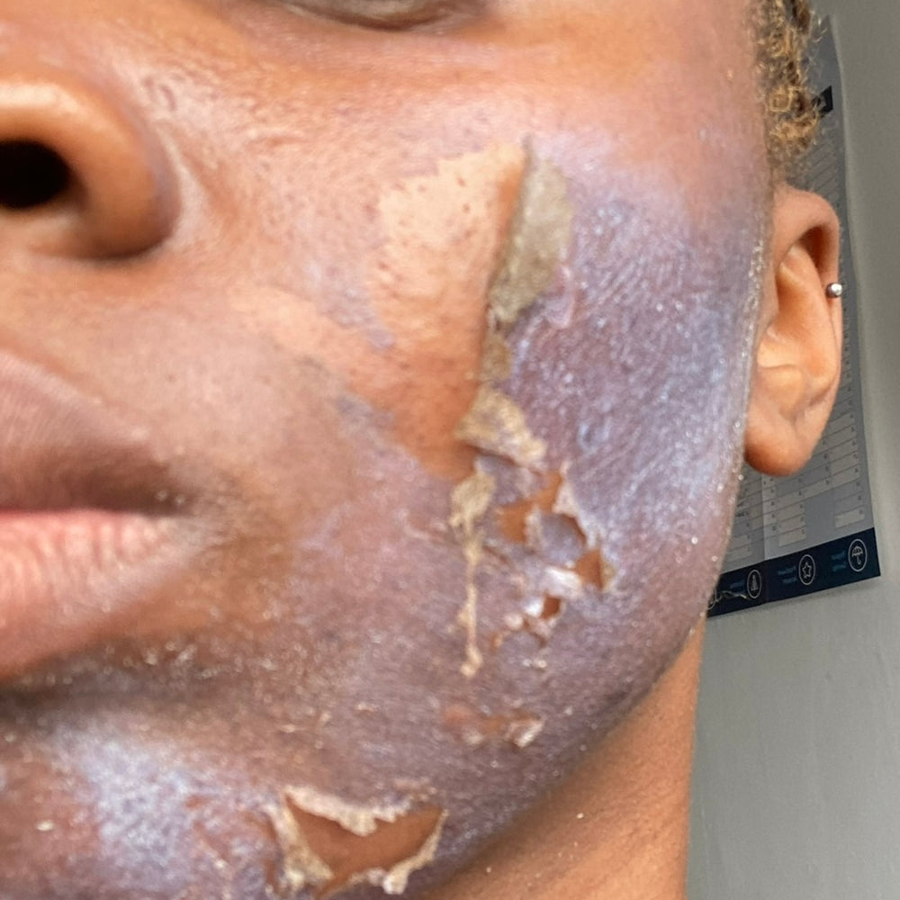 Skin Transformation Result