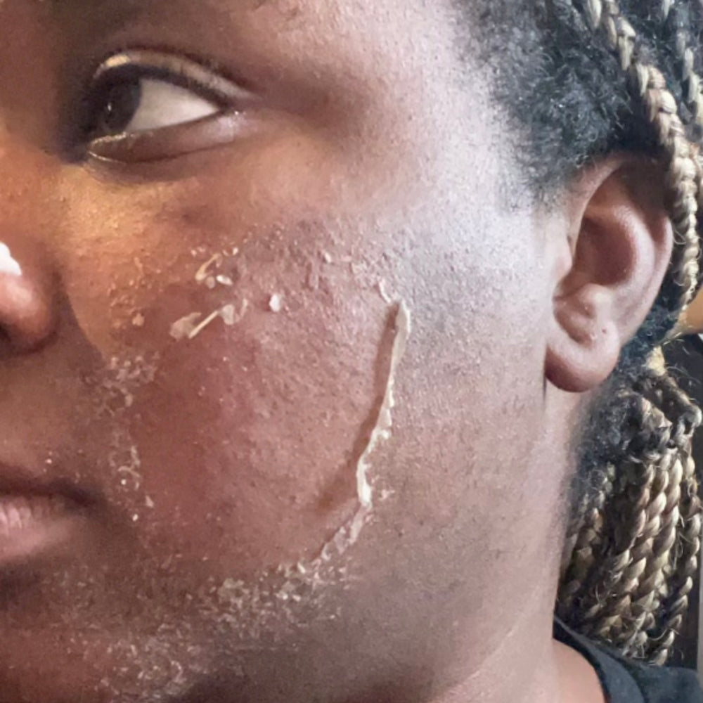 Skin Transformation Result