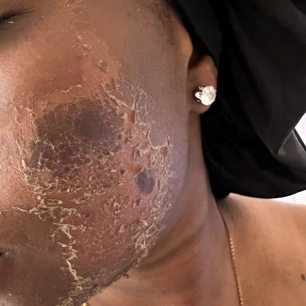Skin Transformation Result