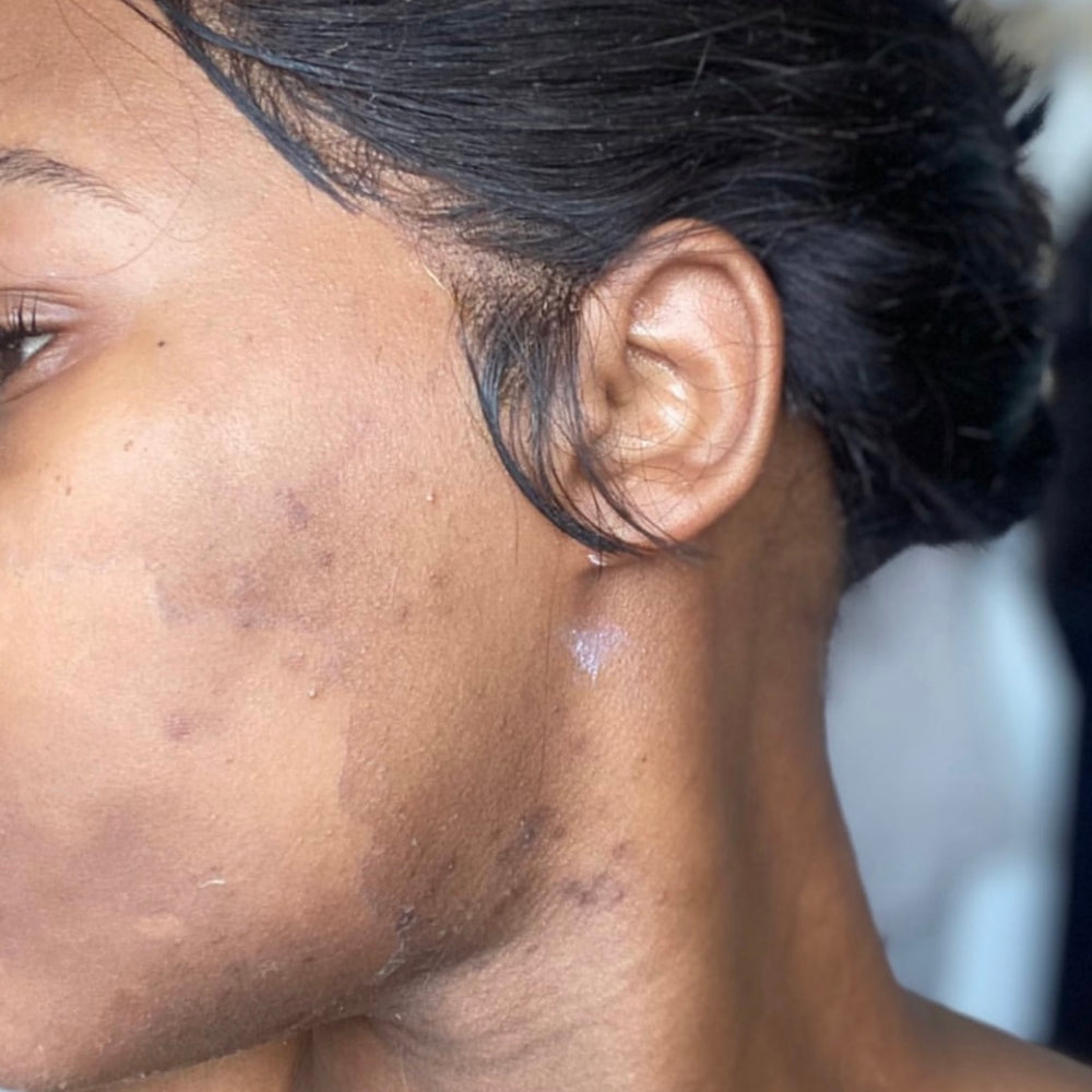 Skin Transformation Result