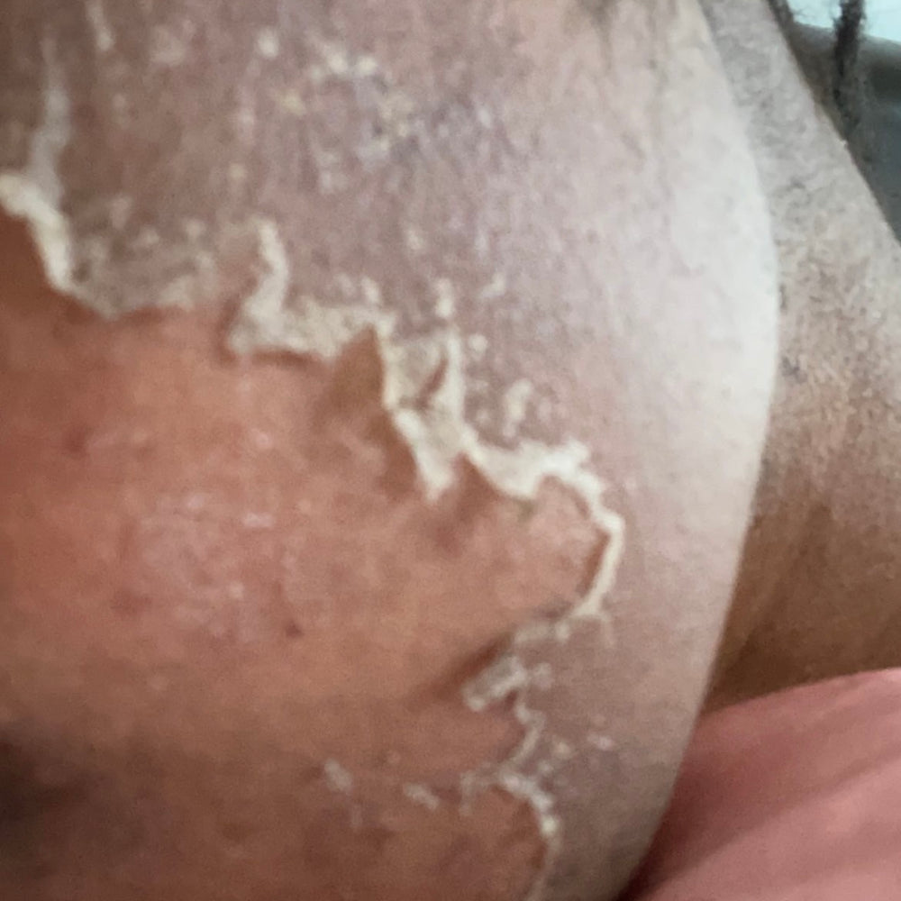 Skin Transformation Result