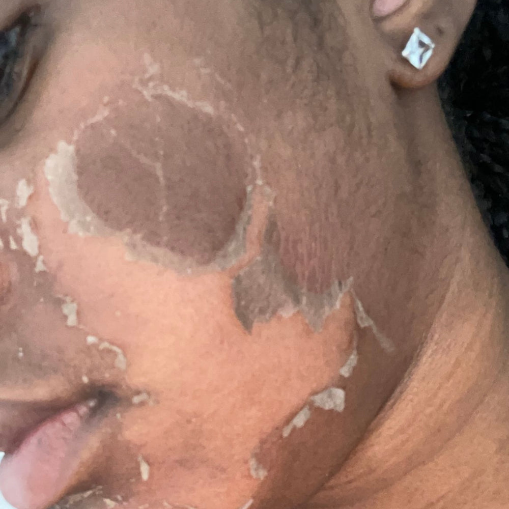 Skin Transformation Result