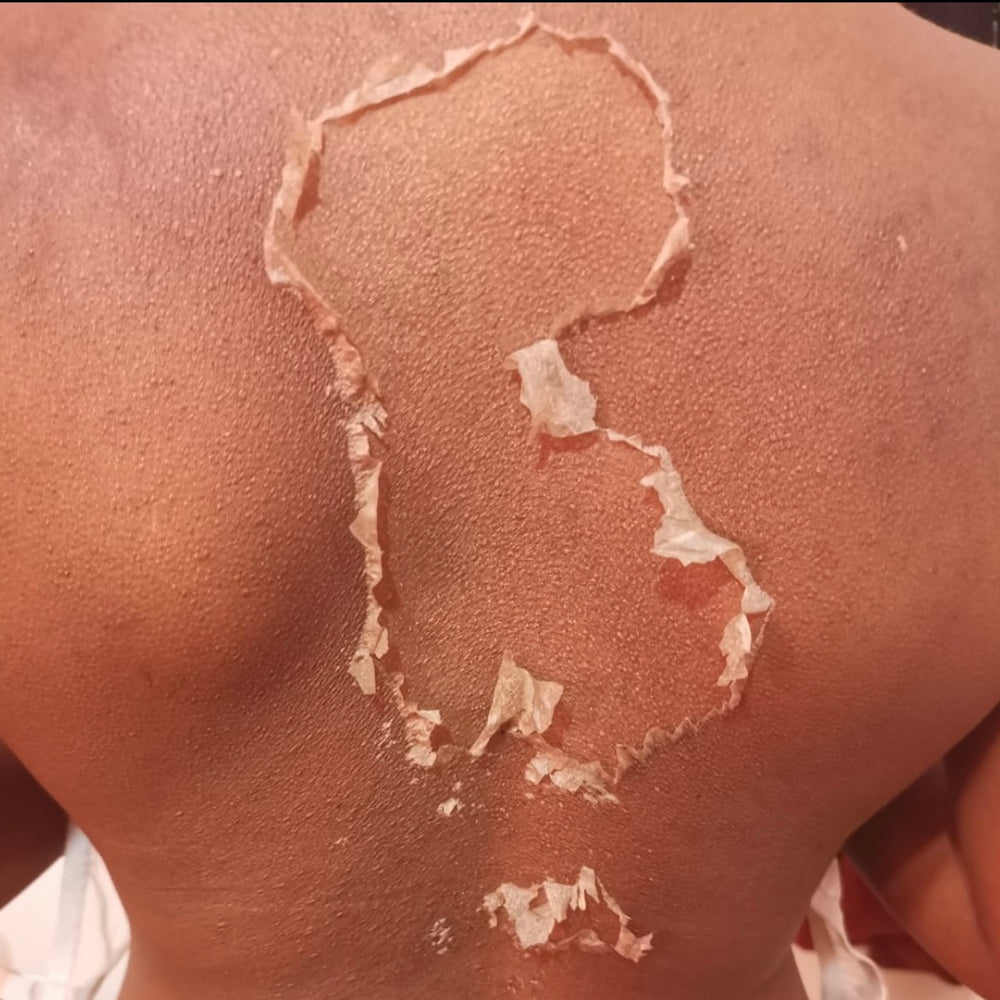 Skin Transformation Result