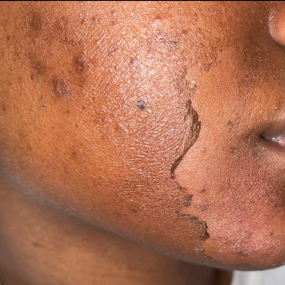 Skin Transformation Result