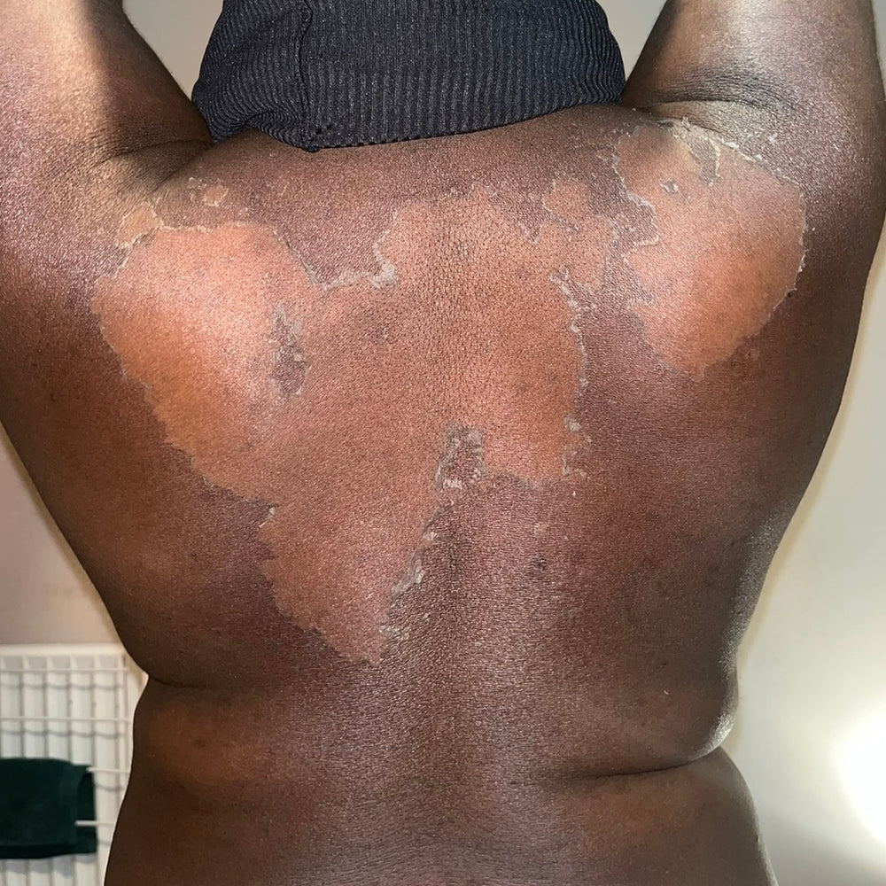 Skin Transformation Result