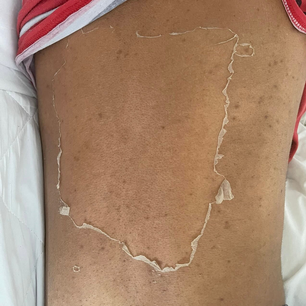 Skin Transformation Result