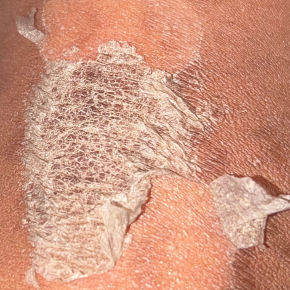 Skin Transformation Result