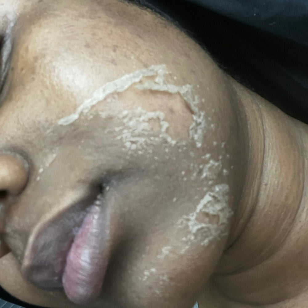 Skin Transformation Result